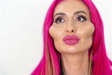 Woman With Worlds Biggest Cheeks Looks Completely Different Without