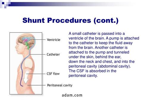 Ppt Care Of The Client With Cranial Surgery Powerpoint Presentation