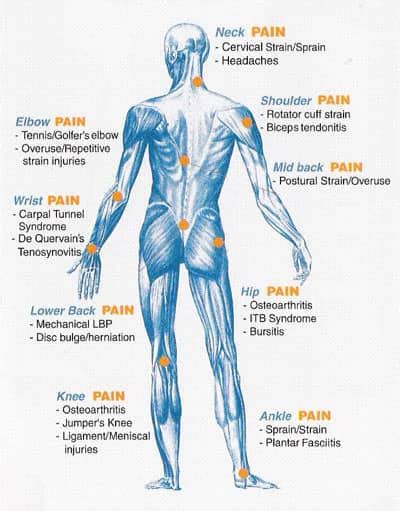 Understanding Nerve Pain Days To Fitness