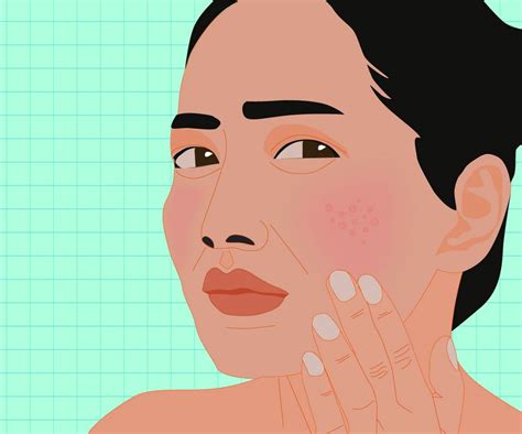 How To Get Rid Of Irritated Skin And Identify Symptoms With Images