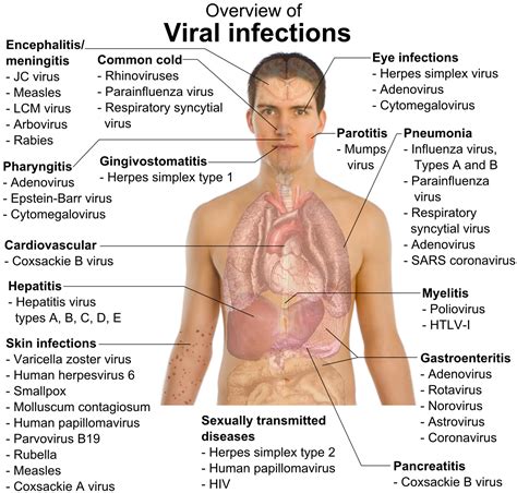 Viral Infections Medical Knowledge Nursing Tips Medical Education