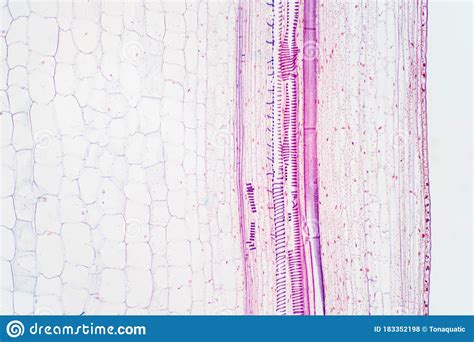 Plant Vascular Tissue Under The Microscope View Stock