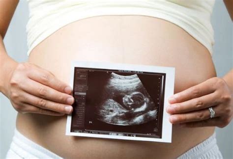 Ini Perkembangan Janin 2 Bulan Pada Kehamilan Moms