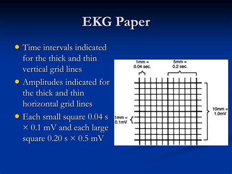 Ppt Ekg 101 Introduction Powerpoint Presentation Free Download