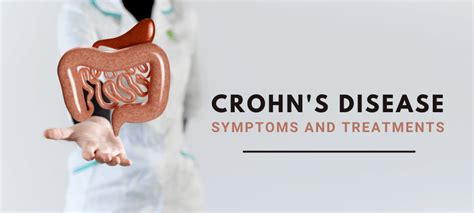 Crohns Disease Symptoms And Treatments Explained Dr Deetlefs