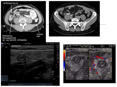 The Abdomen Diagnostic Imaging Approach El Paso Tx