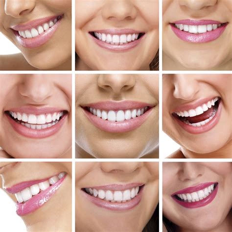 Smile Design Aesthetic Advantage Aesthetic Dental Education Restorative Dental Education