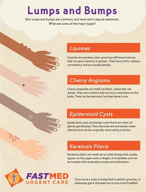 Do You See Lumps And Bumps On Your Skin Infographic Health