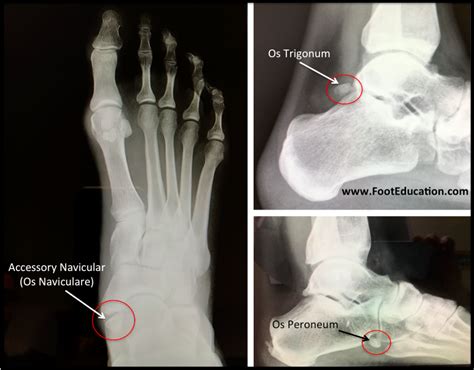 Anatomy Of The Foot And Ankle Orthopaedia Foot And Ankle