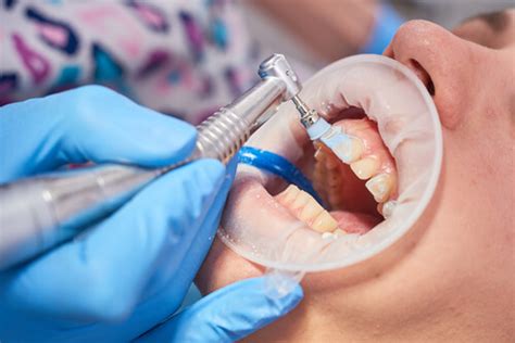 If you have dental insurance, you may end up with some additional costs, based on procedures that are needed before. how much does a dental cleaning cost without insurance - Health CPD