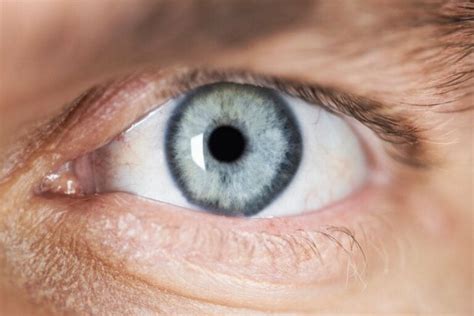 Description And Causes Of Miosis Pinpoint Pupils Step To Health