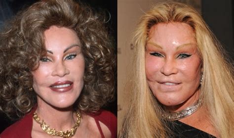 10 Celebrities Who Were Almost Unrecognisable After Plastic Surgery