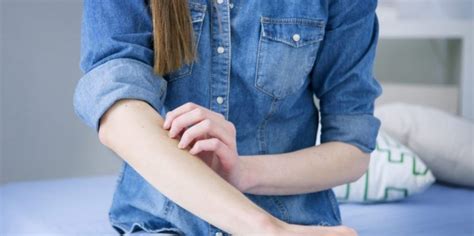 Why Is Eczema An Autoimmune Disease Digi Health Box