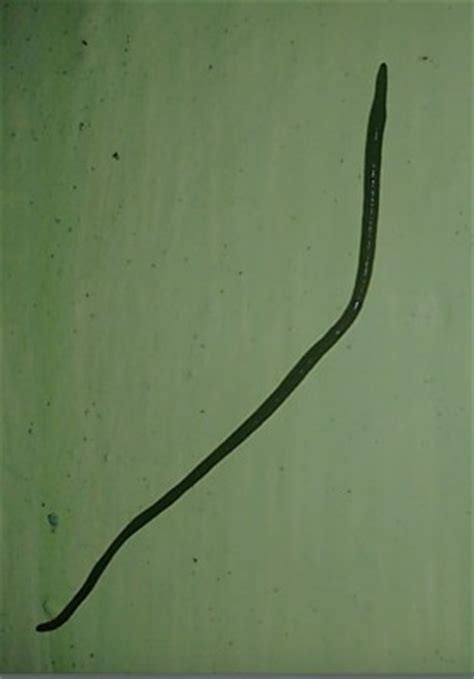 If you notice small brown worms in your toilet tank or bowl, they are likely one of two creatures: Worm Near Toilet is Probably Earthworm - All About Worms