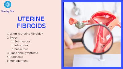 What Is Uterine Fibroids Types Clinical Features Symptoms Diagnosis And Treatment Education
