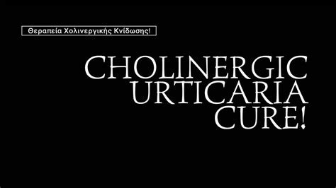 Χολινεργική Κνίδωση Θεραπεία Cholinergic Urticaria Cure Youtube