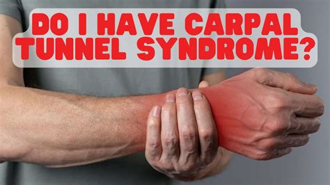 Do I Have Carpal Tunnel Syndrome