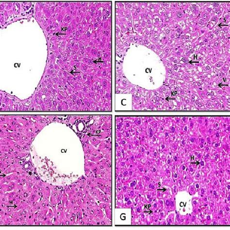 Histopathological Examination Of Mice Liver Stained By H E X400 A
