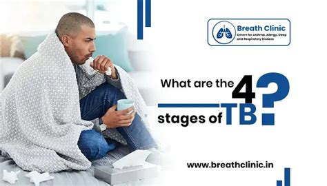 What Are The 4 Stages Of Tb