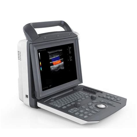 Medical Color Doppler Ultrasound Portable Cw Tdi Cardiac Ultrasound