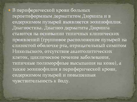 Себорейный дерматит диета питание Дерматит Дюринга Диета Список Запрещенных — Похудение Диета Правильное Дерматит Дюринга Диета Список Запрещенных — Похудение Диета Правильное Себорейный дерматит диета питание