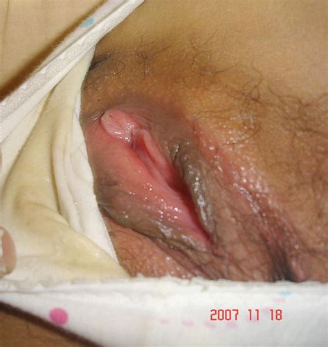 Wet Smelly Pussy Discharge