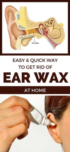Easy And Quick Way To Get Rid Of Ear Wax At Home Dryskinremedies Earwaxblockage Ear Wax Dry