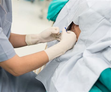 The second injection was cancelled if spontaneous recovery had occurred between inclusion and the first intervention. Caudal Epidural Injectons at Trident Pain Center ...