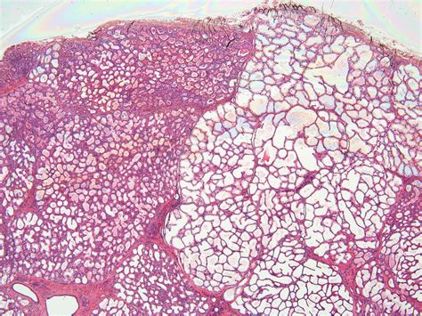 Lactating Mammary Gland Histology 40 X