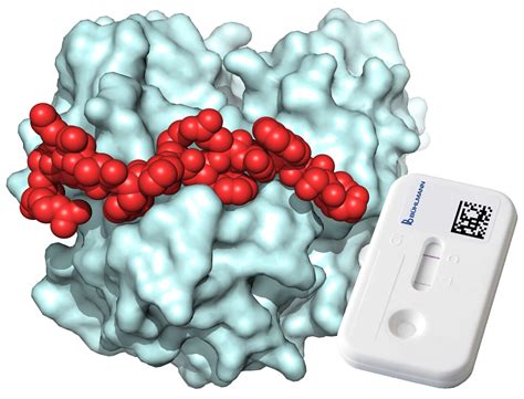 Calprotectin Peptide Assay A Promising New Diagnostic Tool For