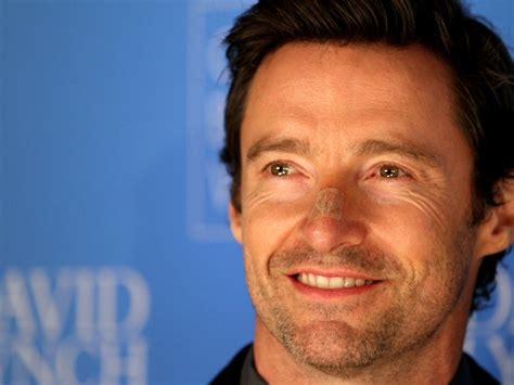 Hugh Jackman Opens Up About Skin Cancer I Thought Id Scratched Myself In A Fight