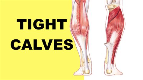 Patellar Tendonitis Exercises Tight Calves And Jumpers Knee Tendonitis