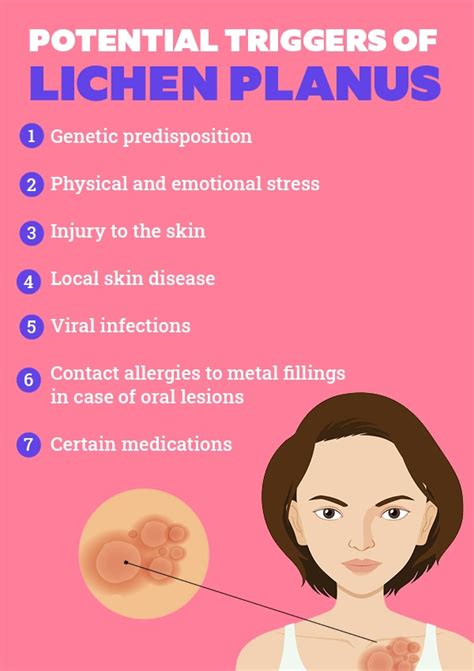 A Dermatologists Guide On Dealing With Lichen Planus Be Beautiful India
