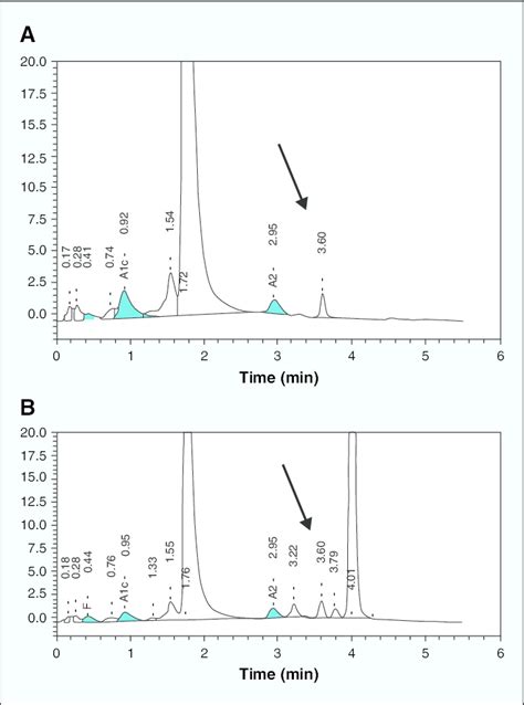 High Performance Liquid Chromatography Results From Patients With A