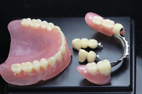 Proteze Mobile Identica Tehnica Dentara