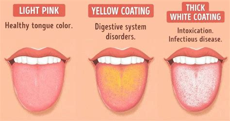 What Your Tongue Can Tell You About Your Health Breckenridge Dental