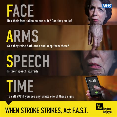Act Fast Stroke Campaign