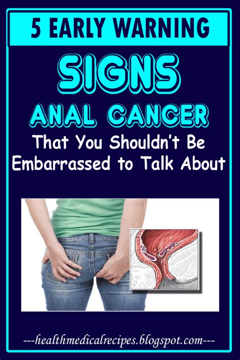5 Early Warning Signs Anal Cancer That You Shouldnt Be Embarrassed To Talk About
