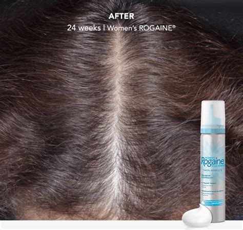 Hair Growth Products For Women Rogaine