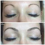 Eyebrow Doctor Pictures