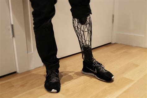 Tomas Vacek Airy Customized 3d Printed Prosthetic Leg Cover