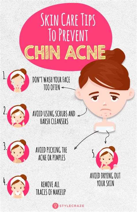 Chin Acne And Pimples Causes Treatment And Skin Care Tips