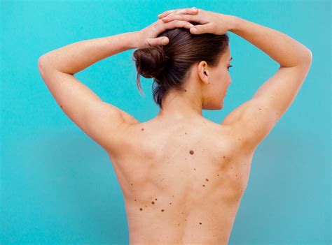 The core is melanin which is a component that is responsible for rendering color to the skin. 10 Signs of Skin Cancer You Shouldn't Ignore | SELF