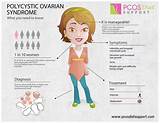 Images of Pcos Doctors