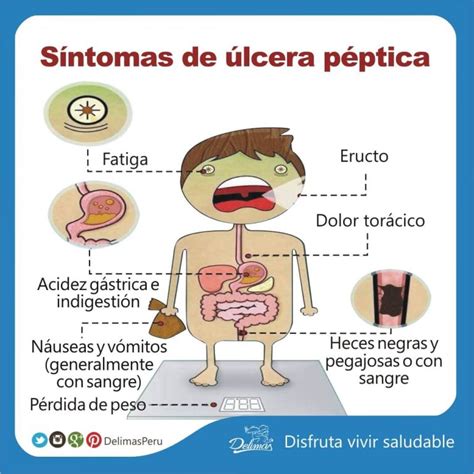 Descubre los síntomas de la úlcera péptica Blog Vive Sano
