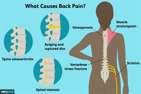 Sore Back Remedies To Manage Pain