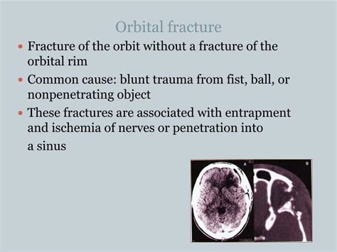 orbital fracture emergencies ocular ppt powerpoint presentation assessment eom abnormal movement trauma blunt