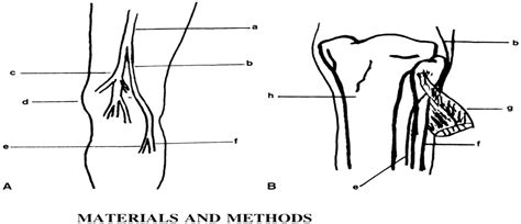 Mri Of The Common Peroneal Nerve Normal Anatomy And Evaluat