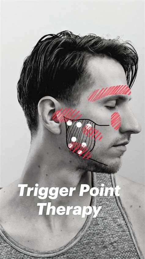 Trigger Point Therapy Trigger Point Therapy Trigger Points Nerve Pain