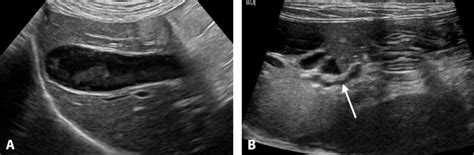 Small Animal Abdominal Ultrasonography Part 2 Liver And Gallbladder